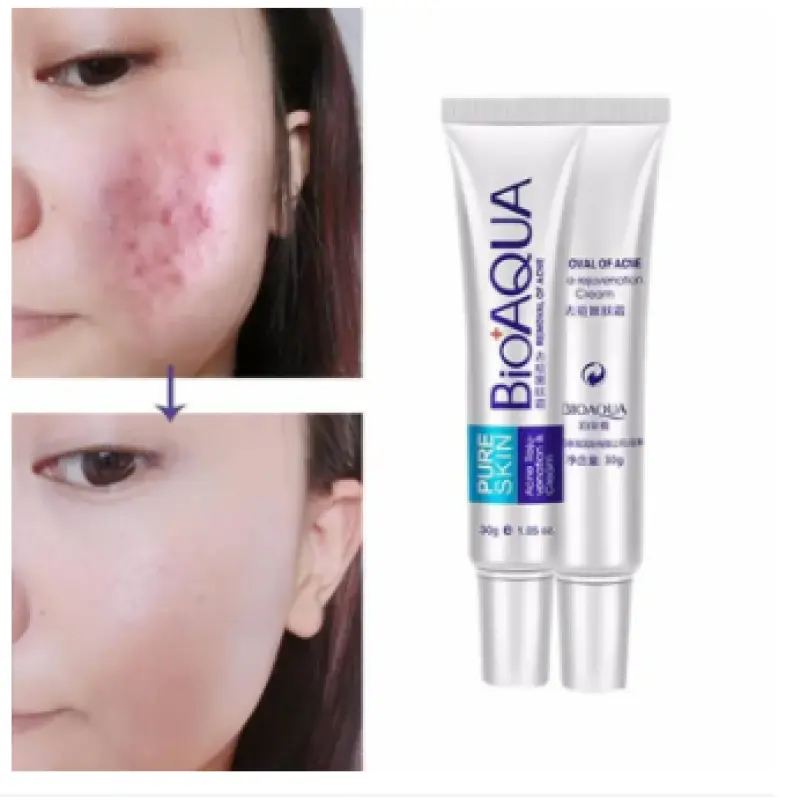 BioAqua Pure Skin ACNE Removal & Rejuvenation Cream – 30 gm