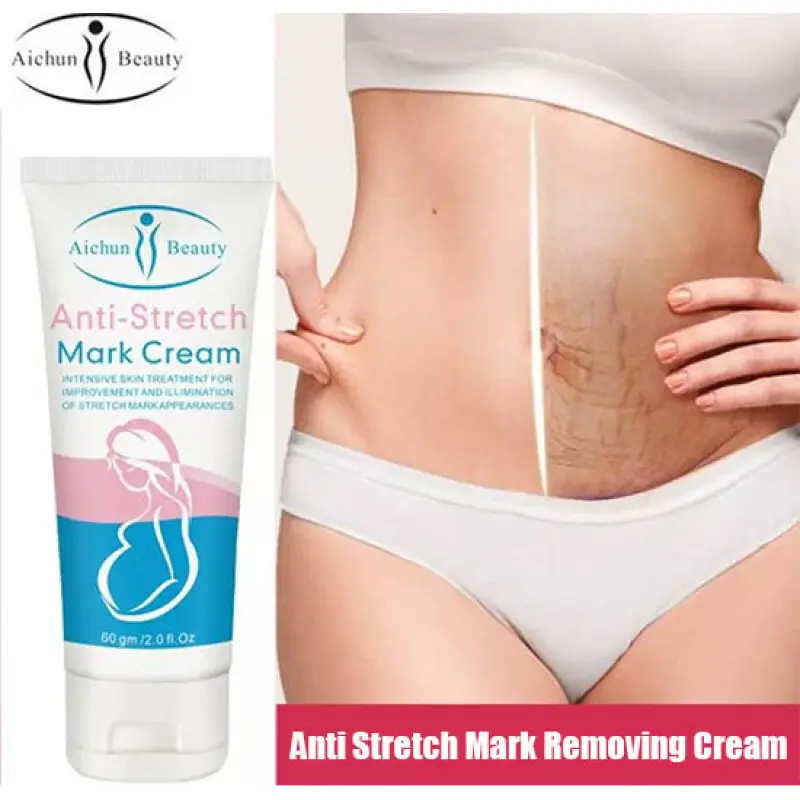 Aichun Beauty Anti-Stretch Marks Cream | Stretch Marks Removal Cream
